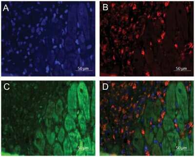 Immunohistochemistry: Renin R Antibody [NB100-1318]